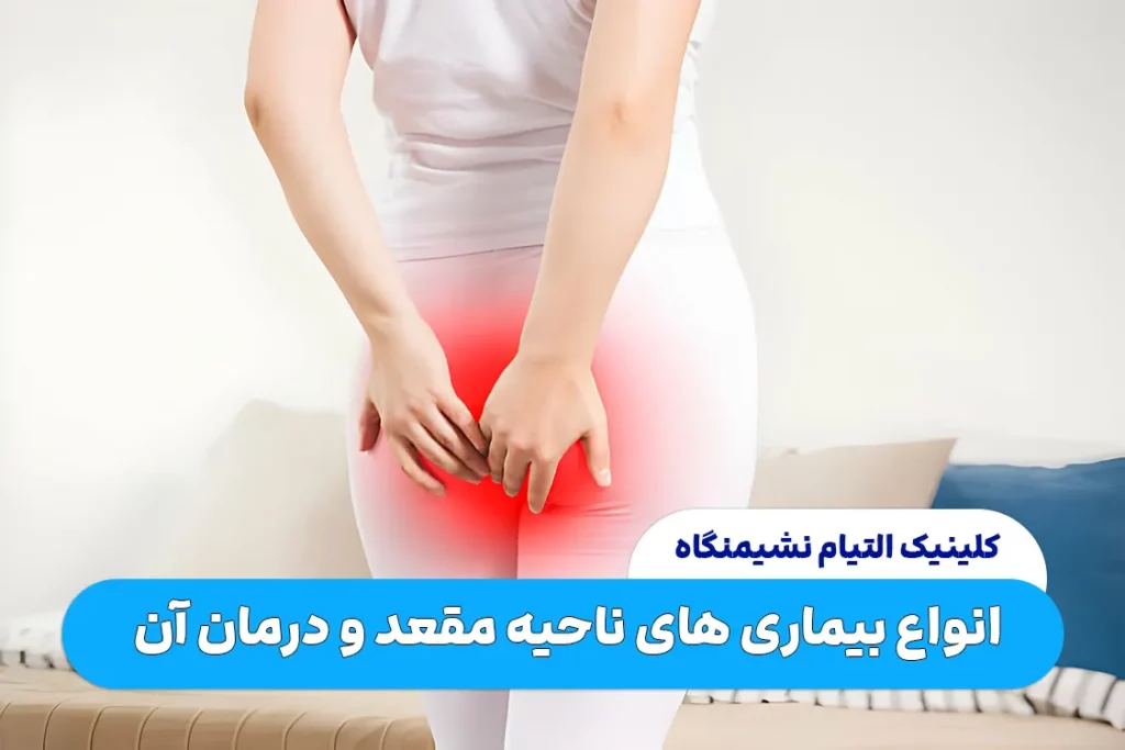 انواع بیماری های ناحیه مقعد و درمان آن