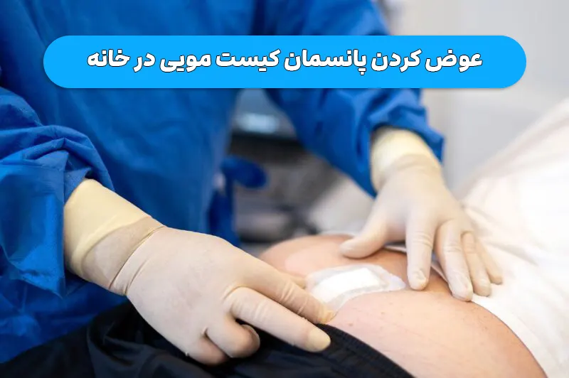 قدم به قدم عوض کردن پانسمان کیست مویی