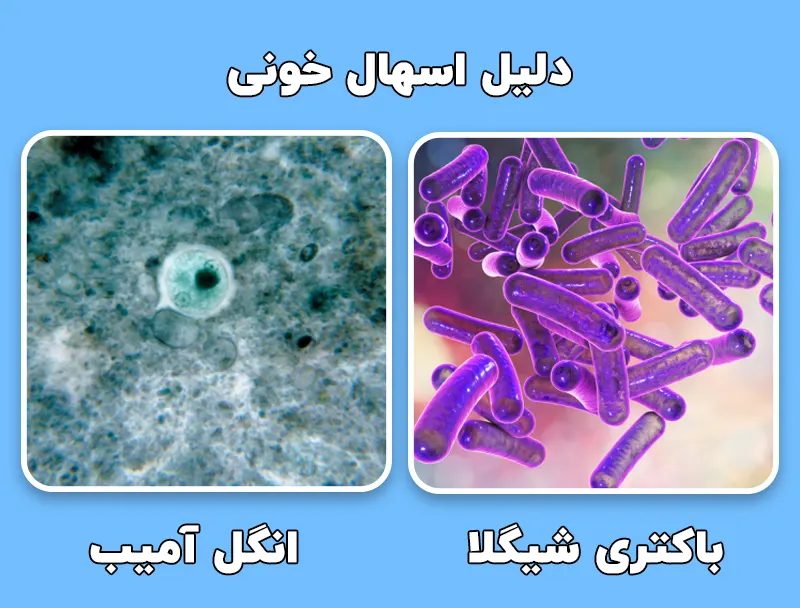 دلیل اسهال خونی