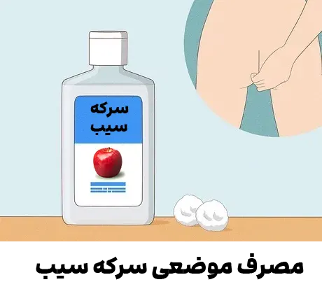 مصرف موضعی سرکه سیب