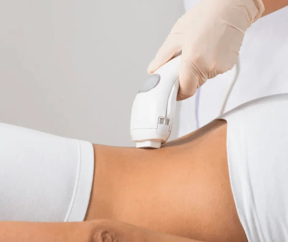 لیزر موی زائد