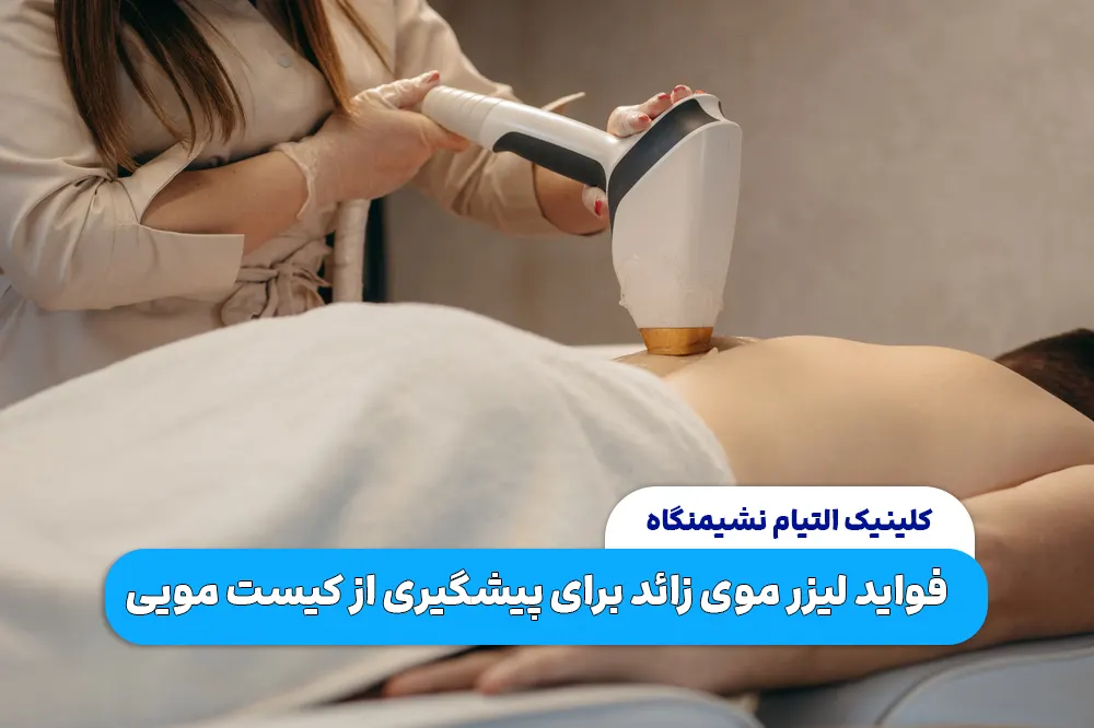فواید لیزر موی زائد برای پیشگیری از کیست مویی