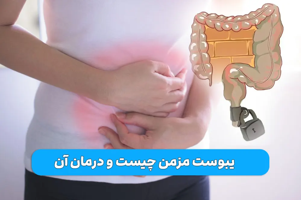 یبوست مزمن چیست و درمان آن