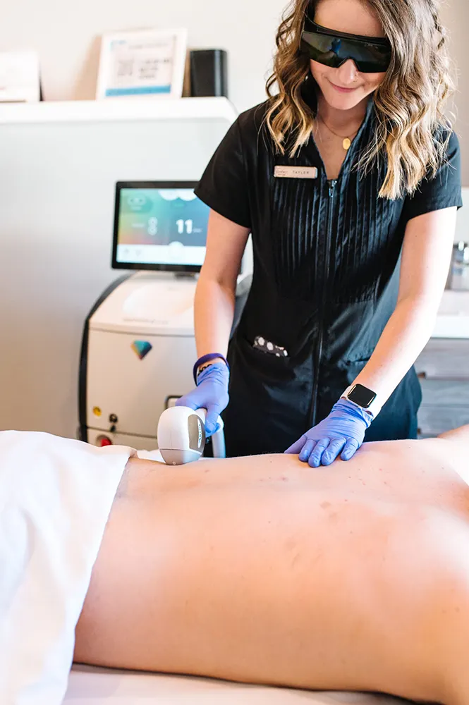 لیزر موی زائد