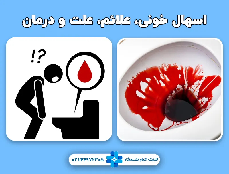 اسهال خونی