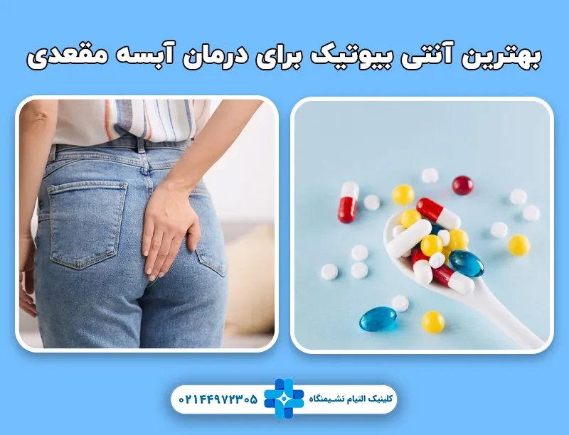 بهترین آنتی بیوتیک ها برای درمان آبسه مقعدی