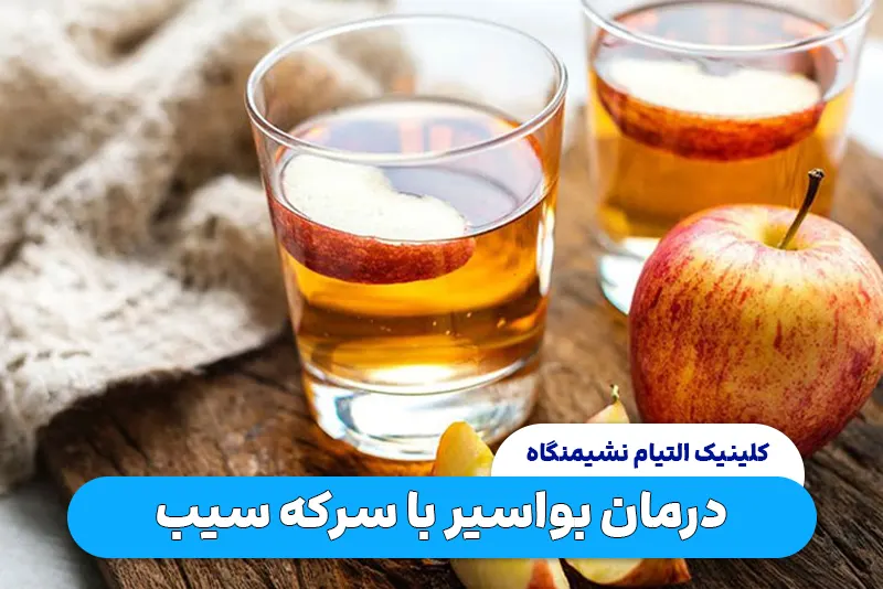 درمان بواسیر با سرکه سیب