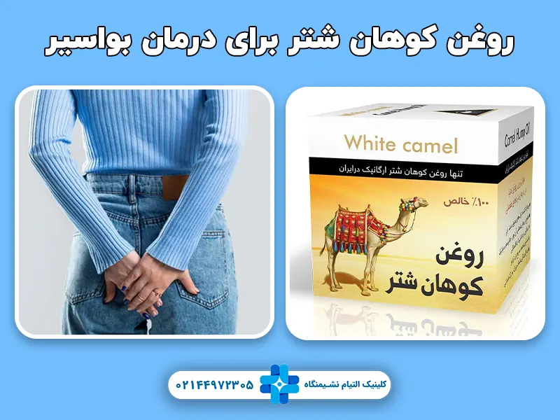 روغن کوهان شتر برای درمان بواسیر