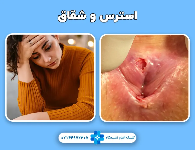 استرس و شقاق