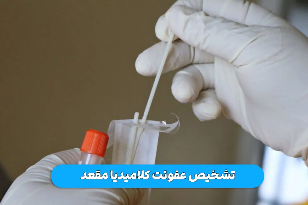 تشخیص عفونت کلامیدیا مقعد