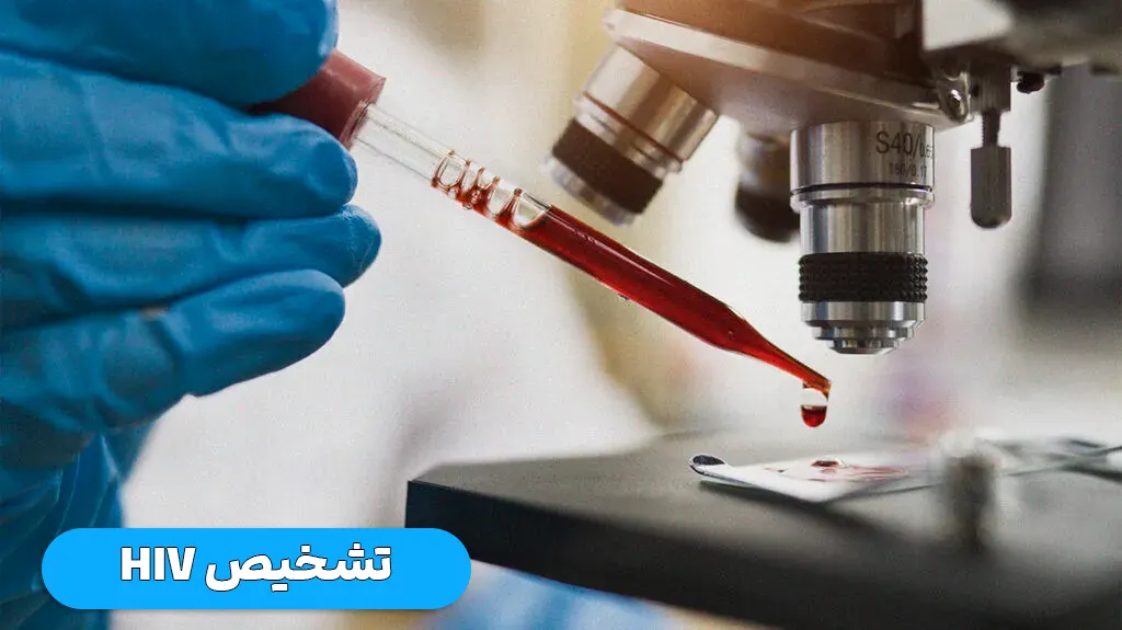 تشخیص hiv
