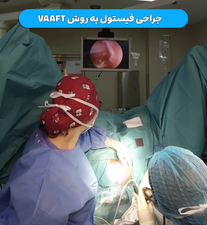 جراحی فیستول به روش vaaft