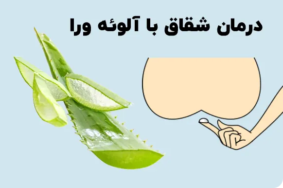 درمان شقاق با آلوئه ورا