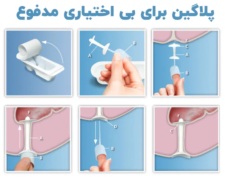 پلاگین برای بی اختیاری مدفوع