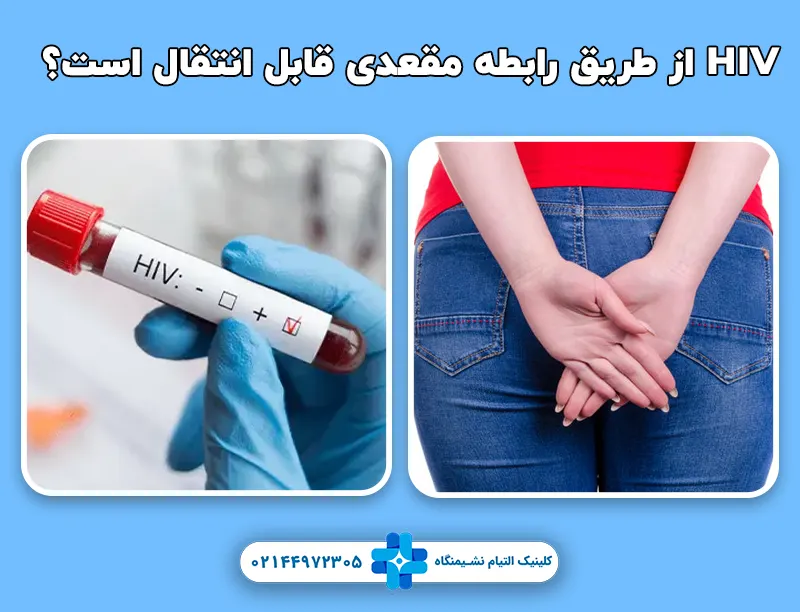 HIV از طریق رابطه مقعدی قابل انتقال است؟