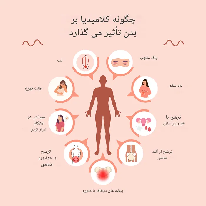 علائم عفونت کلامیدیا