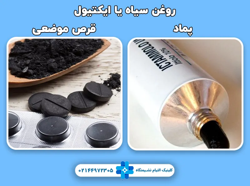 روغن سیاه یا ایکتیول