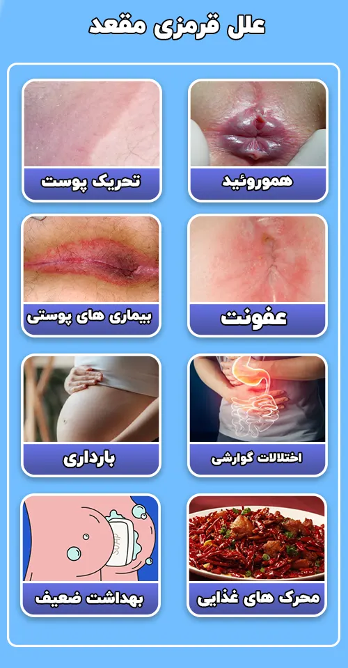 علل قرمزی مقعد