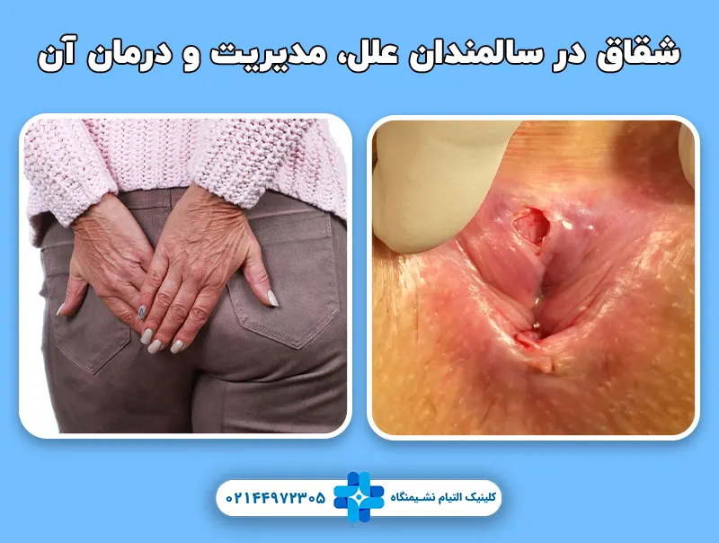 شقاق در سالمندان