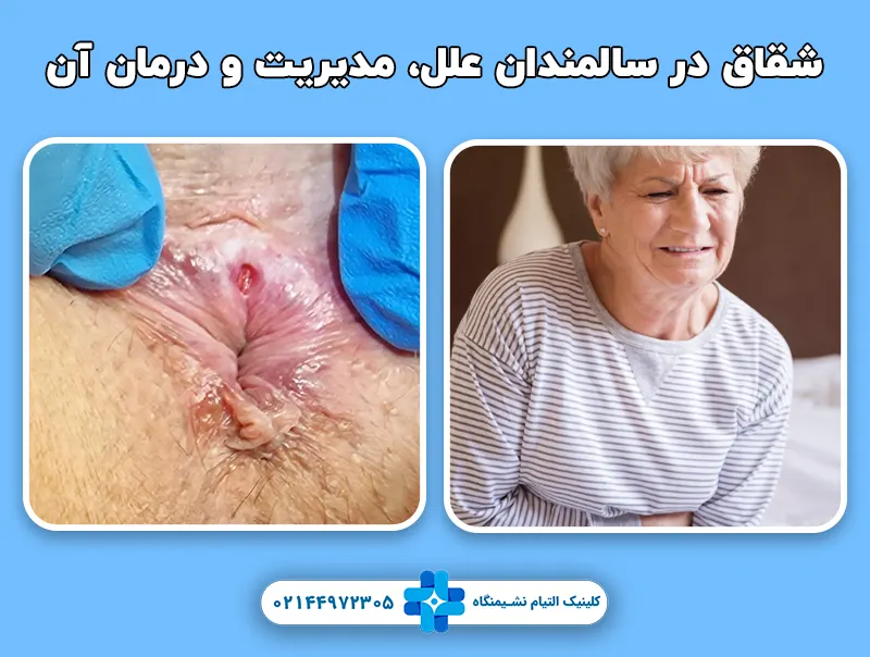 شقاق در سالمندان