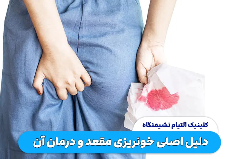 دلیل اصلی خونریزی مقعد و درمان آن