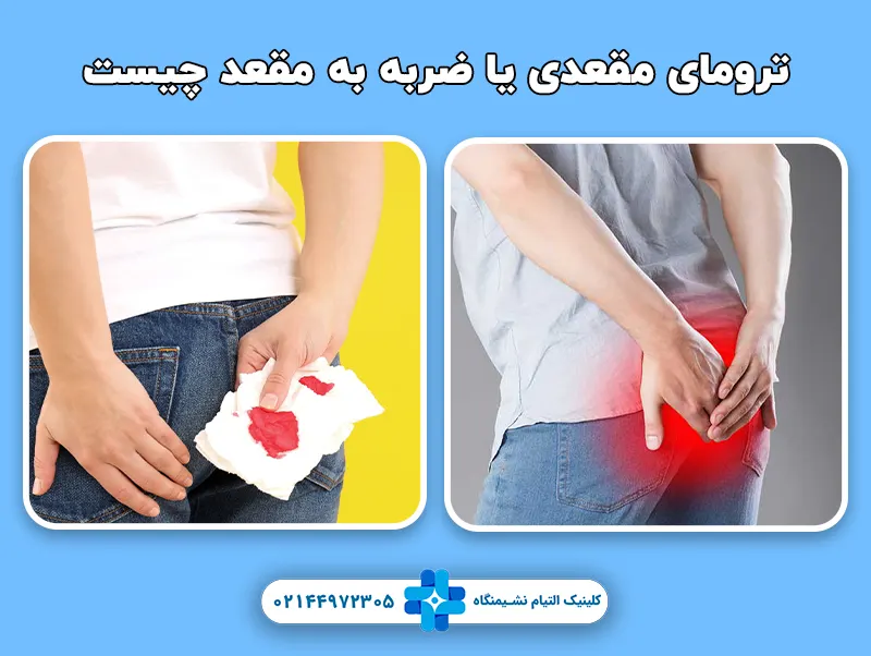 ترومای مقعدی