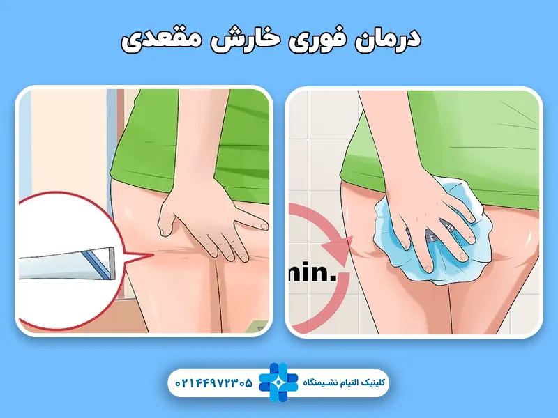 درمان فوری خارش مقعدی