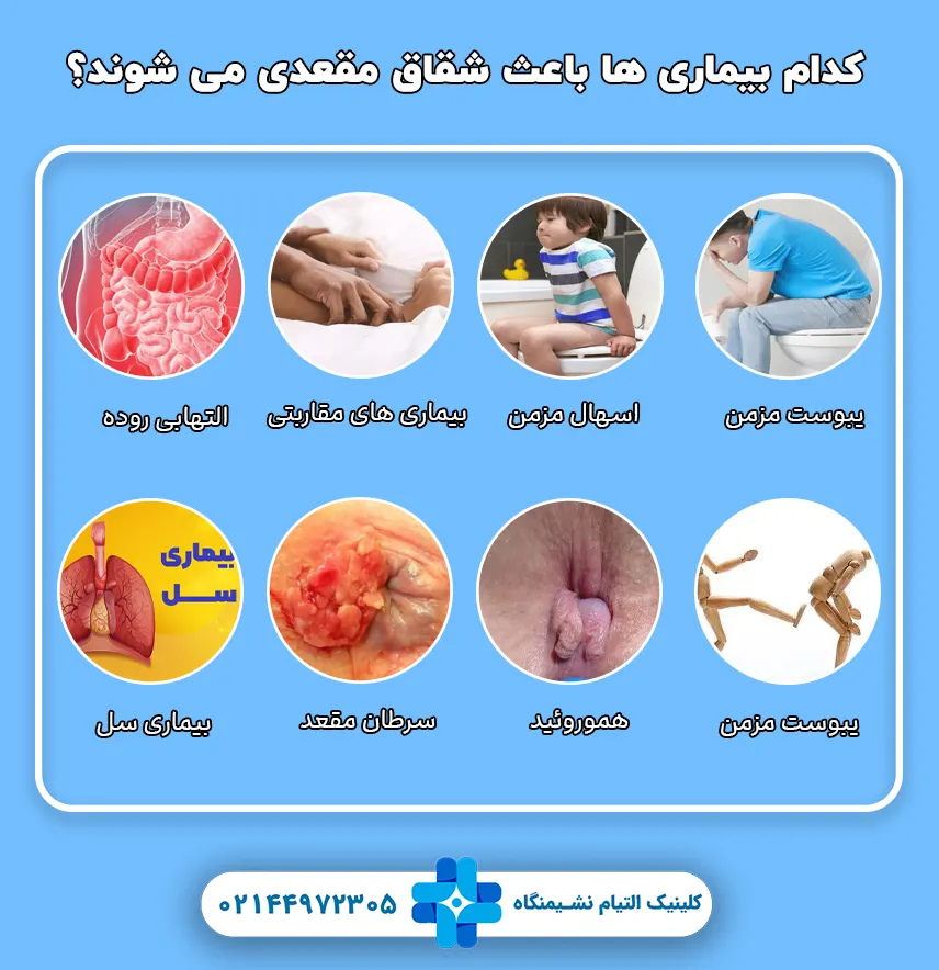 کدام بیماری ها باعث بروز شقاق مقعدی می شوند؟