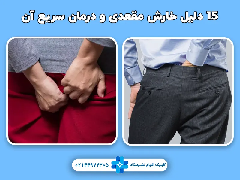 15 دلیل خارش مقعدی و درمان سریع آن