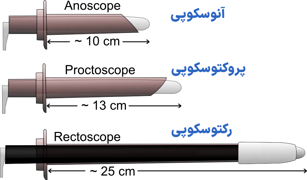 پروکتوسکوپی آنوسکوپی