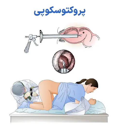 پروکتوسکوپی