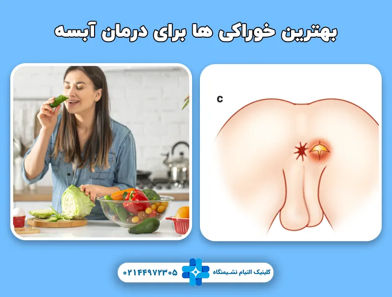 بهترین خوراکی ها برای درمان آبسه