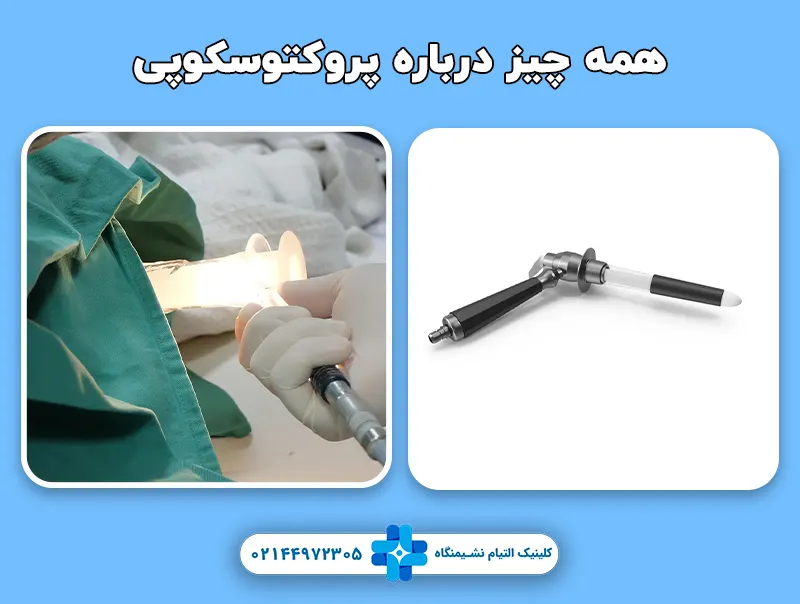 همه چیز درباره پروکتوسکوپی
