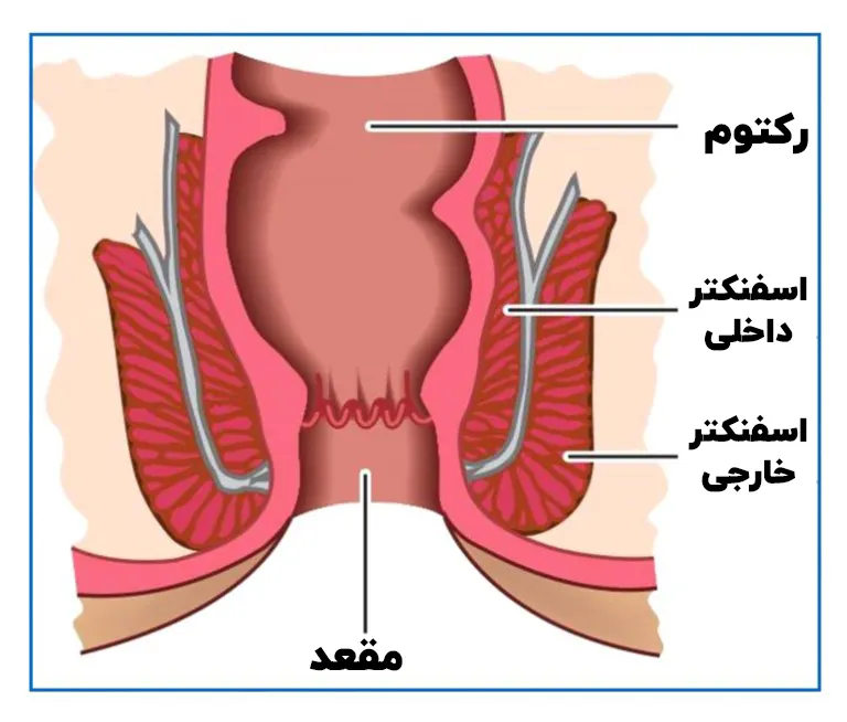 گوشت اضافه مقعدی بعد از زایمان