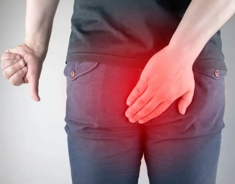 بی حسی مقعد