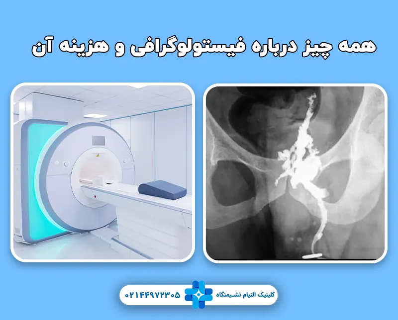 فیستولوگرافی