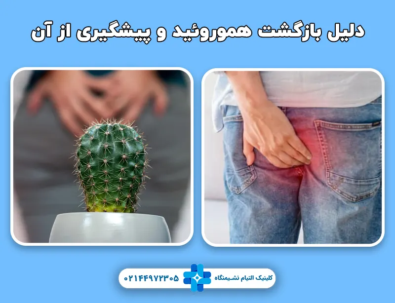 دلیل بازگشت هموروئید