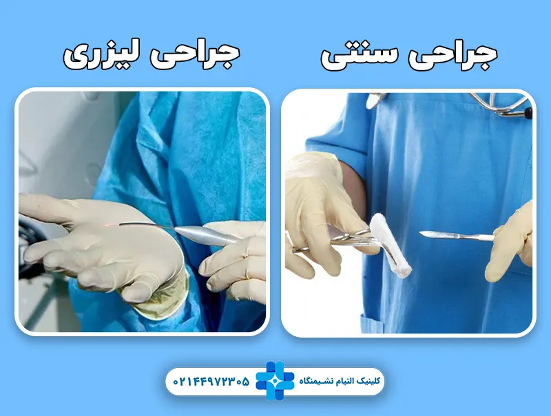 جراحی و لیزر مقعد