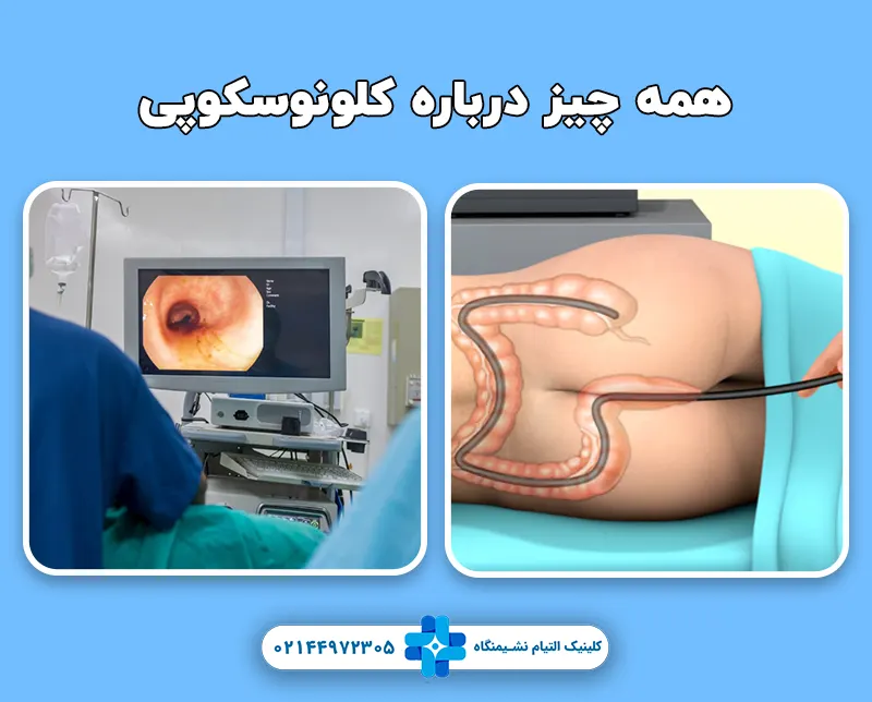 همه چیز درباره کلونوسکوپی