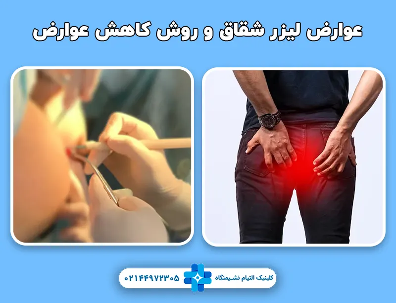 عوارض لیزر شقاق