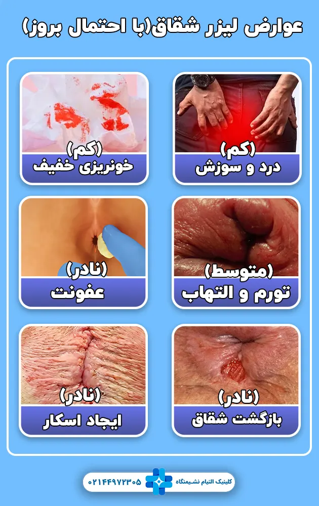 عوارض لیزر شقاق