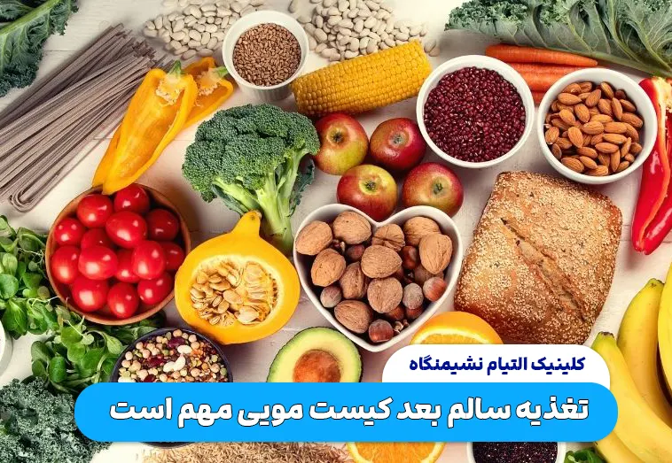 تغذیه سالم بعد کیست مویی