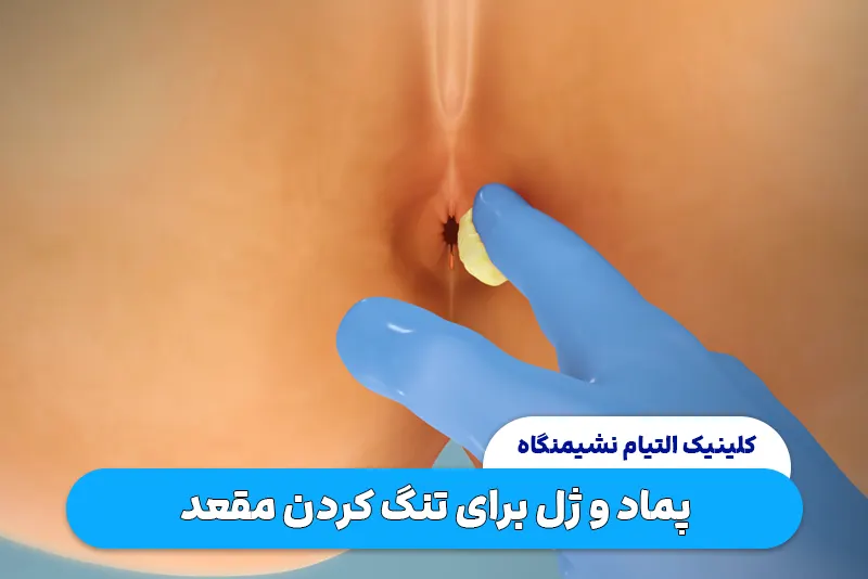 پماد برای تنگ کرده مقعد