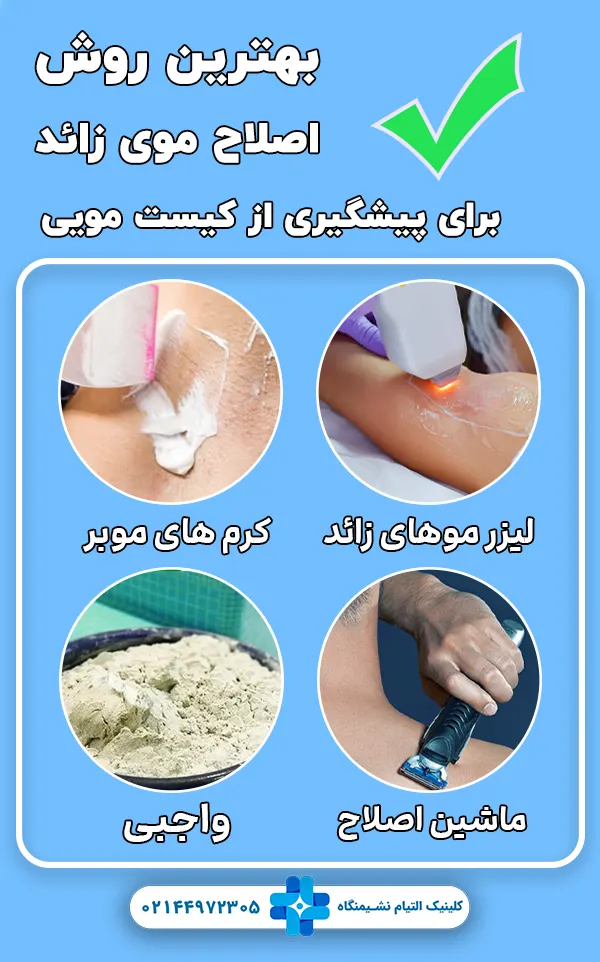 بهترین روش های اصلاح موی زائد برای پیشگیری از کیست مویی