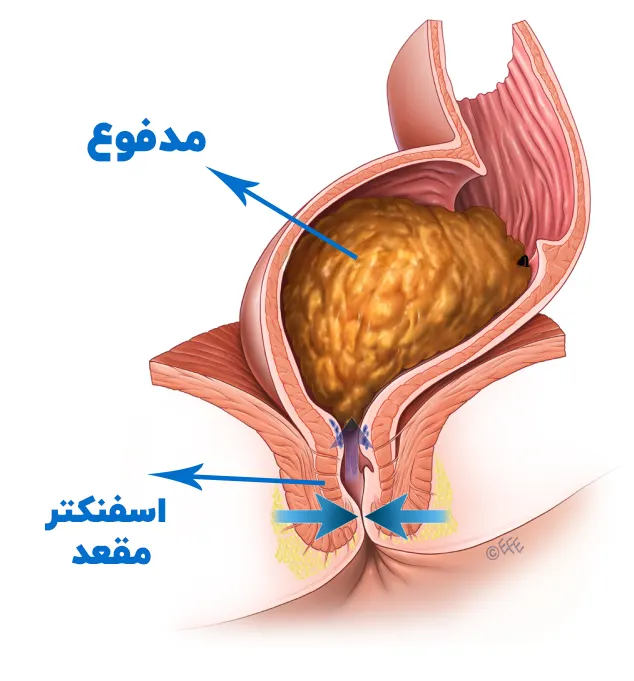 عضلات اسفنکتر مقعد