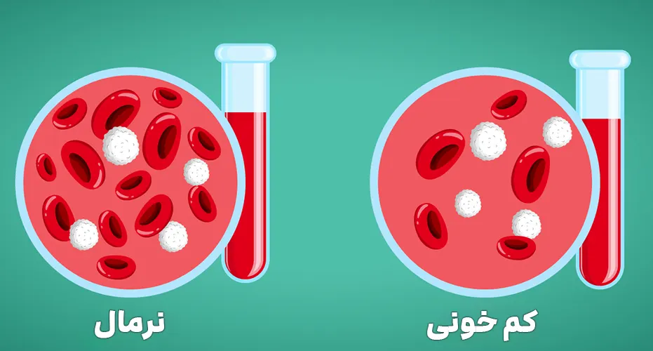 کم خونی