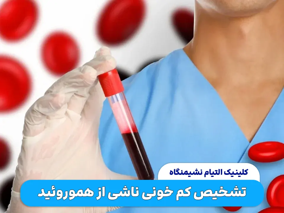تشخیص کم خونی ناشی از هموروئید