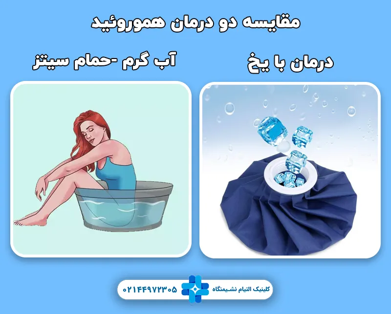  مقایسه درمان هموروئید با یخ و آب گرم