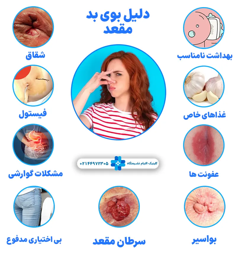 دلیل بوی بد مقعد