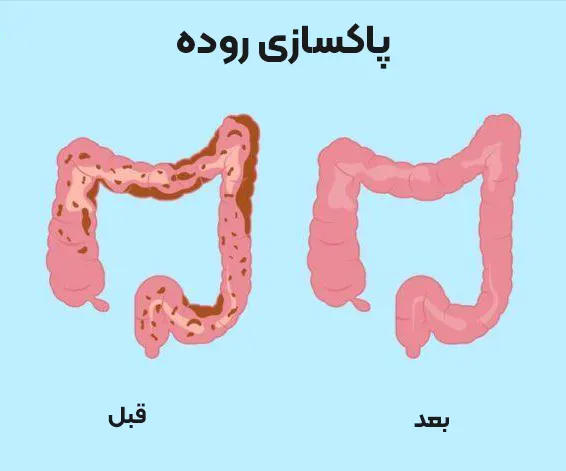 پاکسازی روده